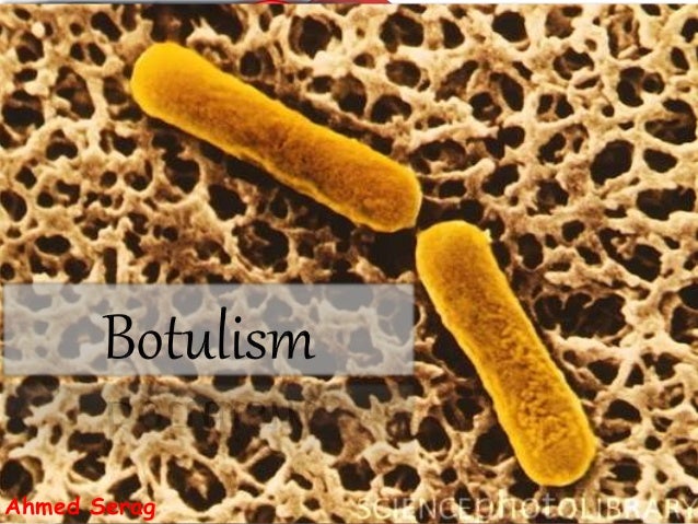Botulism
