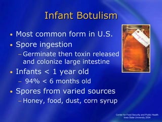 Center for Food Security and Public Health
Iowa State University 2004
Infant Botulism
• Most common form in U.S.
• Spore ingestion
− Germinate then toxin released
and colonize large intestine
• Infants < 1 year old
− 94% < 6 months old
• Spores from varied sources
− Honey, food, dust, corn syrup
 
