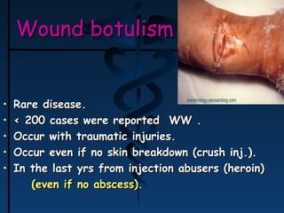 Botulism 1 | PPT