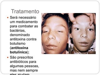 Tratamento
 Será necessário
um medicamento
para combater as
bactérias,
denominado
antitoxina contra
botulismo
(antitoxina
botulínica);
 São prescritos
antibióticos para
algumas pessoas,
mas nem sempre
 