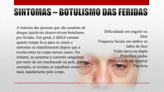 A maioria das pessoas que são usuárias de
drogas injetáveis desenvolvem botulismo
por feridas. Em geral, é difícil estimar
quanto tempo leva para os sinais e
sintomas se manifestarem depois que a
toxina entra no corpo nesses casos. No
entanto, ao penetrar a corrente sanguínea
por meio de um machucado na pele, por
exemplo, as toxinas se espalham muito
mais rapidamente pelo corpo.
Dificuldade em engolir ou
falar
Fraqueza faciais em ambos os
lados da face
Visão turva ou dupla
Pálpebras caídas
Dificuldade em respirar
Paralisia
 