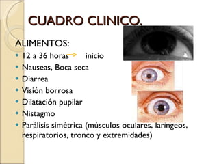 CUADRO CLINICO. ALIMENTOS: 12 a 36 horas  inicio Nauseas, Boca seca Diarrea Visión borrosa Dilatación pupilar Nistagmo  Parálisis simétrica (músculos oculares, laríngeos, respiratorios, tronco y extremidades) 
