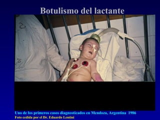 Botulismo del lactante




Uno de los primeros casos diagnosticados en Mendoza, Argentina 1986
Foto cedida por el Dr. Eduardo Lentini
 