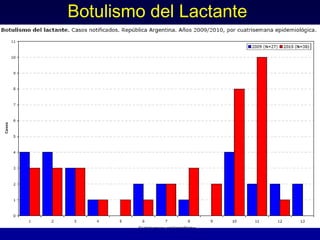 Botulismo del Lactante
 