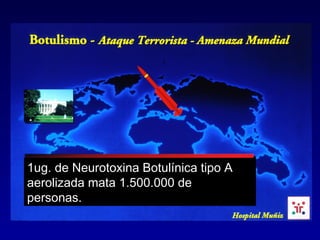 1ug. de Neurotoxina Botulínica tipo A
aerolizada mata 1.500.000 de
personas..
 
