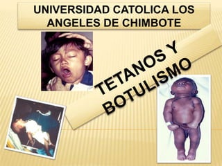UNIVERSIDAD CATOLICA LOS
ANGELES DE CHIMBOTE
 