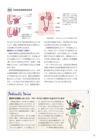 11
図表8 自排尿型新膀胱造設術
活スタイルに合わせて選ぶようにしましょう。
実際に尿路変向術を受けた患者さんに話を聞
くのも参考になります。
●排尿リハビリを受けて退院へ
　膀胱全摘除術と尿路変向術を受けたときに
は１か月程度の入院が必要です。手術後しば
らくは造設したストーマや新膀胱にカテーテル
（管）を入れて尿を出しますが、術後2〜3週
目くらいから、自分で排尿できるように訓練を
行います。自排尿型新膀胱造設術を受けた人
は、新膀胱に４００ml程度尿がたまった時点で
腹圧をかけて排尿するようにします。
　最初は新膀胱が膨らみにくいため、２～３か
月は尿失禁がありますが、パッドを当てれば心
配ありませんし、徐々に失禁もなくなります。
ただ、新膀胱が膨らみすぎ巨大膀胱になると、
尿が残りやすくなるので尿をためすぎないよう
注意します。新膀胱から腸粘液が出る場合は、
自分で尿道へ管を入れ洗浄すると不快感が軽
減されます。ケアの仕方は担当医や看護師に
聞いておきましょう。
　回腸導管造設術などストーマを造設した人
は、入院中にストーマの洗い方や装具のつけ
方の指導を受け、自分で排尿とストーマの管
理ができるように練習します。退院後もストー
マ外来に定期的に通い、心配なことは看護師
などに相談しましょう。
　ストーマをつけた人は、市区町村の福祉担
当課に申請すれば身体障害者手帳が交付され、
乗り物料金などの割引が受けられます。とは
いえ、日常生活にはほとんど支障がないので、
性生活や外出を控える必要はありません。ス
トーマをつけつつ仕事を続けたりスポーツや海
外旅行を楽しんでいる人は大勢います。
Patient's Voice 3
膀胱を全摘除しましたが、スキーやゴルフ旅行にも出かけています
　診断後の説明で、命を考えたら膀胱の
全摘除が最善とはわかったのですが、取
ったら生活がどう変わるのかが不安でした。
自分の腸を使っておなかからおしっこを出
すようにする（回腸導管造設術）と聞い
て決断しました。手術入院は20日ほど。
歩くと回復が早いと聞き、手術の2日後
には歩き始めました。退院から１か月後に
はゴルフにも行っていました。
　夜は長時間用のウロバッグ（尿をため
る袋）にストーマをジョイントして寝ます。
ベッドで寝ていれば、袋を下げておける
ので排尿を気にする必要がありません。
旅先でも洋室にしてもらうなど、多少の
不自由はありますが、趣味のスキーもゴ
ルフも今まで通り続けています。クラブ
ハウスでの入浴は、人に嫌な感じを与え
ないよう、テープで体にパウチを固定す
るなどの処置をして、みんなと楽しんで入
っています。
　今は３か月に１度の定期検診だけ。自
分で排尿の処理もできているので、来年
は10日間の海外旅行も予定しています。
(71歳男性　診断から3年目)
小腸を切除して（～70cm）、
切開して広げ、左右の尿管
をつなぎ膀胱の代用となる
袋をつくる。この代用膀胱
(新膀胱)に尿道を吻合する
ので、手術前と同様に尿道
から排尿できる
「臨床泌尿器科　1998VOL.52 NO.4」医学書院などを参考に作成
腎臓
小腸
（～70cm）
虫垂 尿管
吻合部
尿道
小腸を切開して、
膀胱の代用とな
る袋をつくる
尿管を
つなぐ
盲腸
新膀胱
 