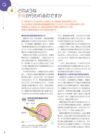 8
完了します。
　ただ、病理検査の結果、さらに念入りに切
除する必要があると判断されたときには、再
度TURBTが実施されることもあります。
　TURBTは開腹手術に比べれば負担の少な
い治療法ですが、出血、膀胱に小さな穴が開
く、発熱などの合併症が発生するというリスク
もあります。また、TURBT後は、ほぼ100
％血尿が出ますし、ほとんどの人は、しばらく
は排尿しにくかったり、排尿のときに痛みを感
じたりします。
　一方で、最大の利点は、TURBTだけで外
科的な治療が終われば膀胱を残せることです。
治療がすべて終わって１か月ぐらいたてば、排
尿の状態もほぼ元通りになります。
●浸潤性がんの標準治療は膀胱全摘除術
　浸潤性がんの場合にはTURBTだけでは不
十分であり、全身麻酔をして開腹し、骨盤内
のリンパ節と膀胱をすべて摘出する膀胱全摘
除術を行うのが標準治療です。膀胱に隣接し
ている臓器にもがんが広がっている危険性が
あるので、男性は前立腺と精嚢、女性は子宮、
場合によっては卵巣、腟の一部まで一緒に摘
出します。また、尿道にもがんが広がっている
ときには、尿道も切除します。
　膀胱を摘出すると尿をためる袋がなくなって
しまうので膀胱全摘除術と同時に、尿路変向
術を受ける必要があります（p.10～11）。
　膀胱全摘除術の主な合併症は、出血と腸閉
塞です。出血に備えて自分の血液を取ってお
き、それを手術中に輸血することもあります。
前立腺と直腸が癒着していた場合には、癒着
をはがすときに直腸に穴が開くケースがありま
す。まれに大きな穴が開いた場合は一時的に
●経尿道的膀胱腫瘍切除術とは
　膀胱がんでは、まず全員に、経尿道的膀胱
腫瘍切除術（TURBT）が行われます。TURBT
は、下半身麻酔（腰椎麻酔）を行い、切除用
の膀胱鏡を尿道の出口から膀胱内に挿入し、
モニターでがんの場所を確認しながら高周波
電気メスで病変を切除する方法です（図表6）。
　病変の大きさや数にもよりますが、治療時
間は30分～2時間程度で、一般的には４～5
日の入院が必要です。病変部の場所によって
は、足が動いてしまうことを防ぐために、足の
つけ根に麻酔薬を投与する閉鎖神経ブロック
を行う場合もあります。
　TURBTの目的は、①膀胱内のがんを取り
除く、②切除した病変を顕微鏡でみる病理検
査で詳しく調べ、がんかどうか、がんであれば
その広がり方、タイプ、悪性度を確定診断す
ることです。TURBTは検査と治療を兼ねてい
ます(p.5)。
　生検の結果、表在性がんか上皮内がんであ
ることがわかれば、開腹手術で膀胱を取り除く
必要はなく、TURBTだけで外科的な治療は
4
Q
A．表在性がんや上皮内がんの場合には、膀胱鏡と高周波電気メスで
がんを切除する経尿道的膀胱腫瘍切除術（TURBT）を行い膀胱は温存します。
浸潤性がんの場合には、膀胱全摘除術で膀胱と周囲のリンパ節、
隣接する臓器を摘出するのが標準治療です。
どのような
手術が行われるのですか
図表6
経尿道的膀胱腫瘍切除術
（TURBT）
「膀胱がん　受診から診断、治療、経過観察への流れ」
国立がん研究センターがん情報サービスなどを参考に作成
膀胱鏡
がん
前立腺
膀胱
尿道
 