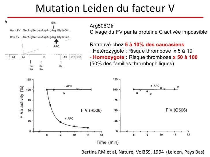 Mutation G20210a Du Gène De La Prothrombine à L'état Hétérozygote