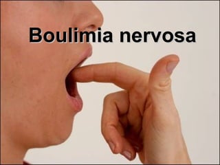 Boulimia nervosa   