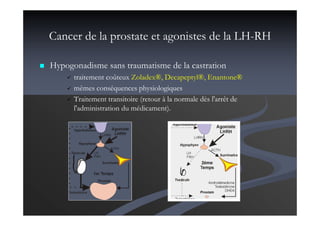 Cancer de la prostate et agonistes de la LH-RH
Hypogonadisme sans traumatisme de la castration
traitement coûteux Zoladex®, Decapeptyl®, Enantone®
mêmes conséquences physiologiques
Traitement transitoire (retour à la normale dès l'arrêt de
l'administration du médicament).
 