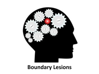 Boundary Lesions
 