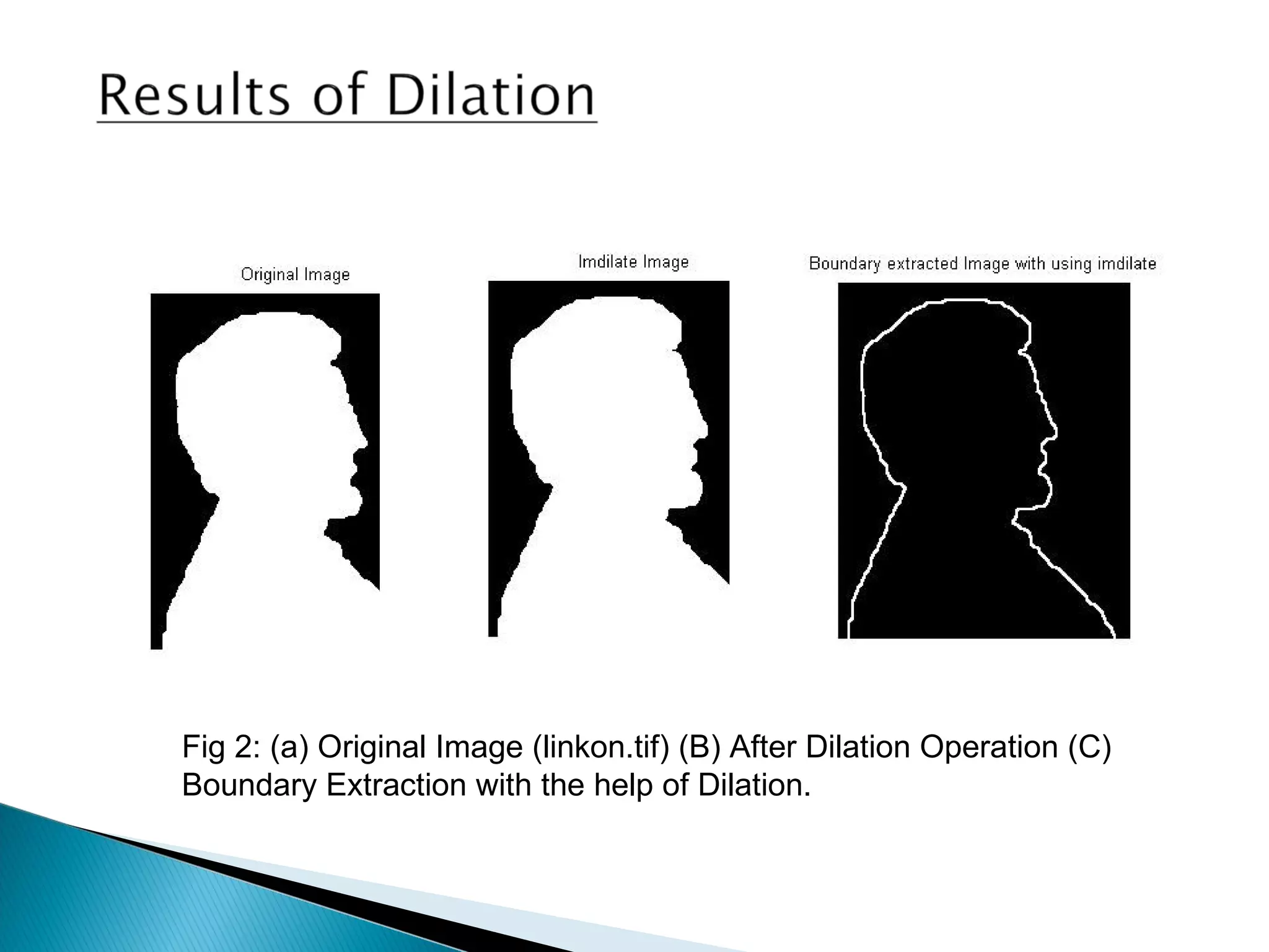 Fig 2: (a) Original Image (linkon.tif) (B) After Dilation Operation (C)
Boundary Extraction with the help of Dilation.
 