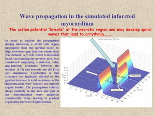 The action potential “breaks” at the necrotic region and may develop spiral
                     waves that lead to arrythmia.....
 
