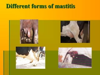 Different forms of mastitisDifferent forms of mastitis
 