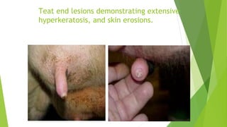 Teat end lesions demonstrating extensive
hyperkeratosis, and skin erosions.
 