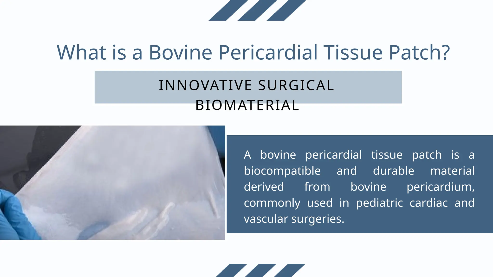 Bovine Pericardial Tissue Patch for Pediatric Surgery | PPTX