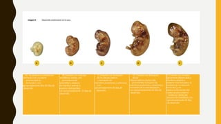 (A) Se observa un embrión en
formación con curvatura
pronunciada en
forma de C, con
aproximadamente 28 a 30 días de
desarrollo.
(B) Embrión con vesículas
encefálicas visibles, con
prominencia del
telencéfalo y esbozos
de miembro anterior y
posterior distinguibles,
con aproximadamente 35 días de
desarrollo.
(C) Embrión con formación
de los lóbulos ópticos
y formación de
miembros posteriores y anteriores,
con
aproximadamente 40 días de
desarrollo.
(D). Embrión con formación
de los
lóbulos ópticos mucho más
prominentes, formación de
miembros posteriores y anteriores y
formación de la vascularización,
con aproximadamente 42 días de
desarrollo.
(E) Embrión con el rostro
ligeramente diferenciado y
miembros anterior y
posterior más formados, se
mantiene la curvatura en
forma de C y se
observa la formación del
meato acústico externo
visible por detrás del
proceso de mandíbula, con
aproximadamente 45 días
de desarrollo.
A B C D E
Imagen 8: Desarrollo embrionario en la vaca.
 