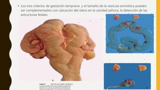 • Los tres criterios de gestación temprana y el tamaño de la vesícula amniótica pueden
ser complementados con ubicación del útero en la cavidad pélvica, la detección de las
estructuras fetales
Imagen 8. Útero de vaca preñado. (A) Observa
una leve asimetría del cuerno izquierdo respecto al
derecho,) el cual una vez abrimos encontramos las
B.
A.
C.
 