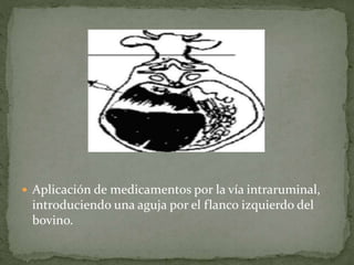  Aplicación de medicamentos por la vía intraruminal,
introduciendo una aguja por el flanco izquierdo del
bovino.
 