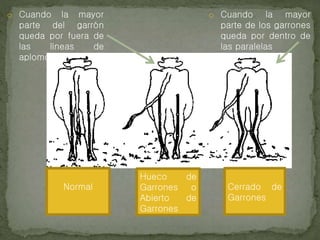 o Cuando la mayor
parte del garrón
queda por fuera de
las líneas de
aplomo
o Cuando la mayor
parte de los garrones
queda por dentro de
las paralelas
Hueco de
Garrones o
Abierto de
Garrones
Cerrado de
Garrones
Normal
 