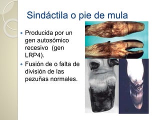 Sindáctila o pie de mula
 Producida por un
gen autosómico
recesivo (gen
LRP4).
 Fusión de o falta de
división de las
pezuñas normales.
 