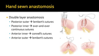  Double layer anastomosis
 Posterior outer  lembert’s sutures
 Posterior inner  over-and-over
continuous sutures
 Anterior inner  connell’s sutures
 Anterior outer  lembert’s sutures
 