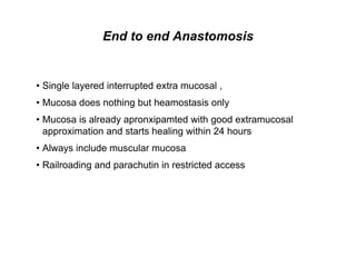End to end Anastomosis
• Single layered interrupted extra mucosal ,
• Mucosa does nothing but heamostasis only
• Mucosa is already apronxipamted with good extramucosal
approximation and starts healing within 24 hours
• Always include muscular mucosa
• Railroading and parachutin in restricted access
 