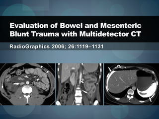 RadioGraphics 2006; 26:1119–1131
Evaluation of Bowel and Mesenteric
Blunt Trauma with Multidetector CT
 