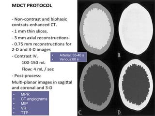 • MPR
• CT angiograms
• MIP
• VR
• TTP
• Arterial: 35-40 s
• Venous:60 s
 