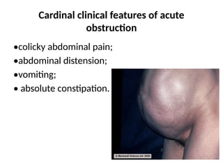 Cardinal Absolute Summary of bowel obstruction.in surgery.145pptx | PPTX