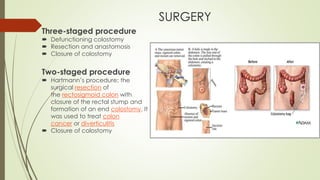 SURGERY
Three-staged procedure
 Defunctioning colostomy
 Resection and anastomosis
 Closure of colostomy
Two-staged procedure
 Hartmann’s procedure: the
surgical resection of
the rectosigmoid colon with
closure of the rectal stump and
formation of an end colostomy. It
was used to treat colon
cancer or diverticulitis
 Closure of colostomy
 