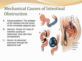 Bowel obstruction colorectal ca | PPTX