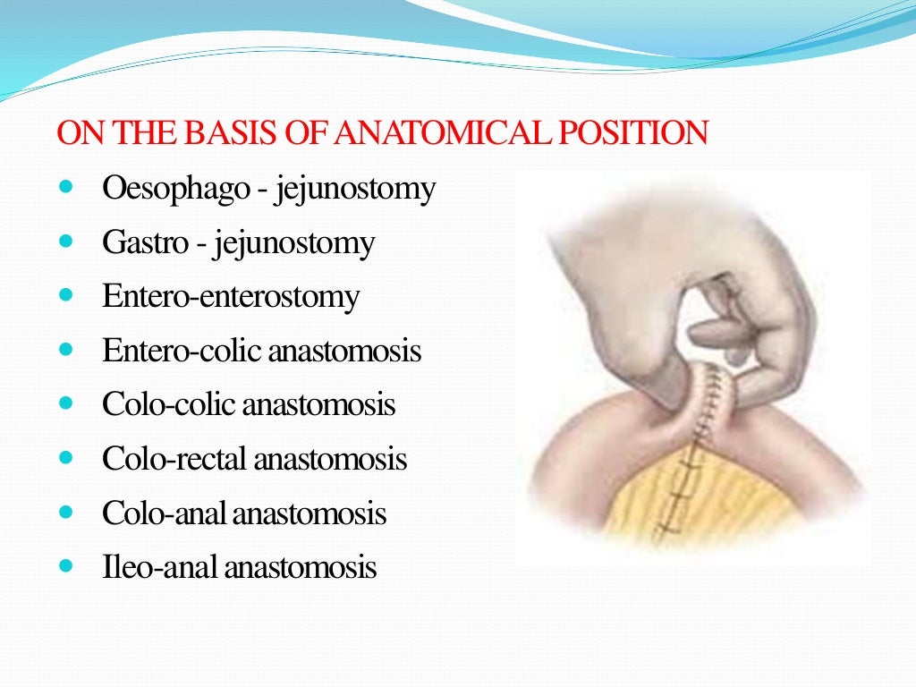 Bowel resection and anastomosis
