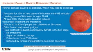 Copyright (c) 2017 by STORM Insights Inc. All Rights Reserved.
HEALTHCARE EXAMPLE: DIABETIC RETINOPATHY DIAGNOSIS
Retinal damage caused by diabetes, which may lead to blindness 
Accounts for 12% of new cases of blindness in the US annually

Leading cause of blindness for ages 20-64

At least 90% of new cases could be reduced  
with proper treatment and monitoring

Aﬀects up to 80%of people with diabetes for 20+ years

Often has no early warning signs

Non-proliferative diabetic retinopathy (NPDR) is the ﬁrst stage

No symptoms

Signs not visible to the eye 

Patients can have 20/20 vision

Detected by fundus photography to see micro aneurisms
"Medical gallery of Mikael Häggström 2014". WikiJournal of Medicine 1 (2).
DOI:10.15347/wjm/2014.008. ISSN 2002-4436. Public Domain.
https://en.wikipedia.org/w/index.php?title=Diabetic_retinopathy&oldid=783900921
 