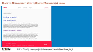 https://verily.com/projects/interventions/retinal-imaging/
DIABETIC RETINOPATHY: VERILY (GOOGLE/ALPHABET) & NIKON
 
