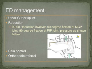 Ulnar Gutter splint
 Reduction
   90-90 Reduction involves 90 degree flexion at MCP
    joint, 90 degree flexion at PIP joint, pressure as shown
    below:




 Pain control
 Orthopedic referral
 