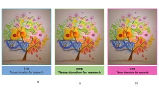 EPB
Tissue donation for research
EPB
Tissue donation for research
EPB
Tissue donation for research
8
9 10
 