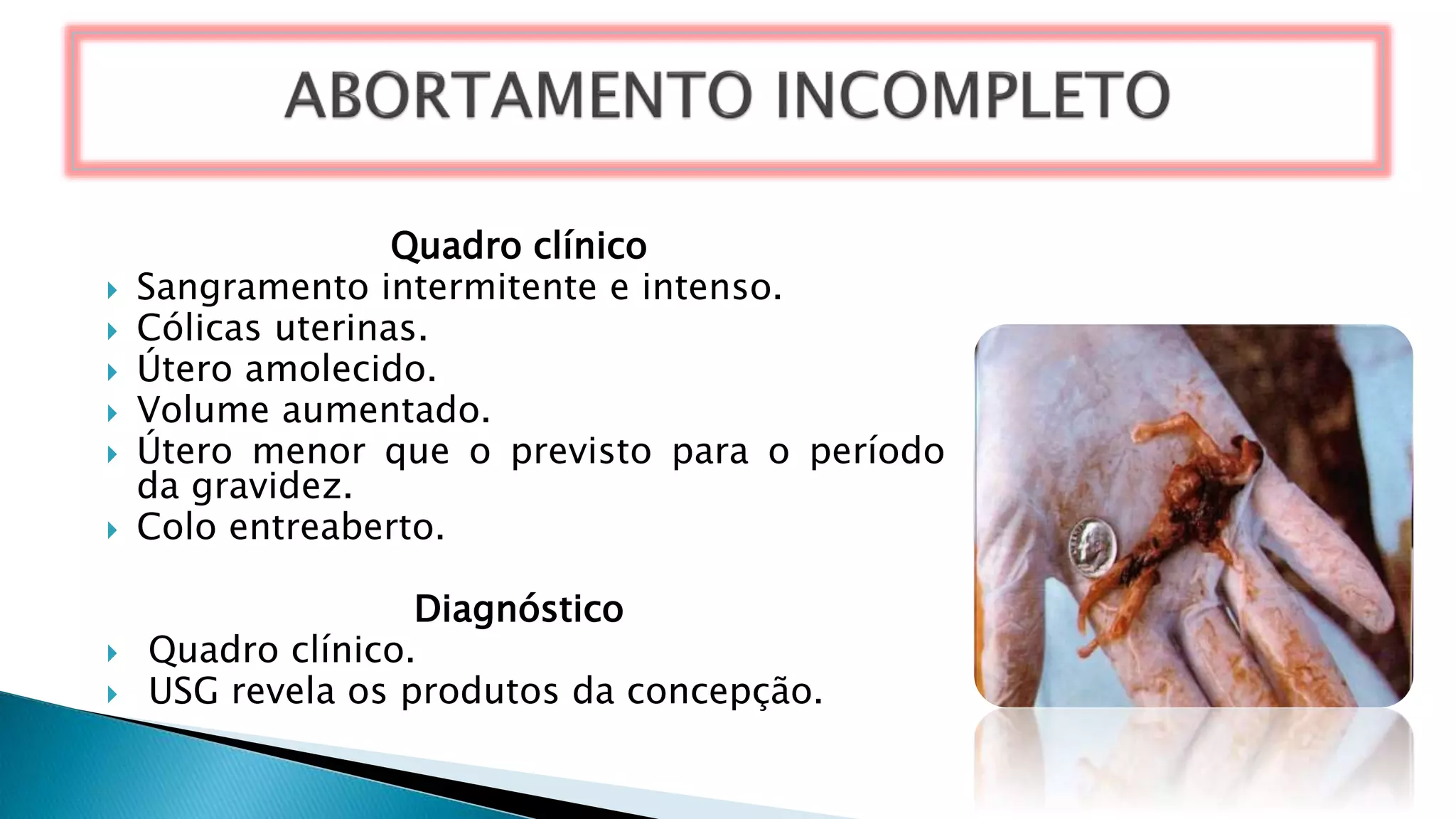 Quadro clínico
 Sangramento intermitente e intenso.
 Cólicas uterinas.
 Útero amolecido.
 Volume aumentado.
 Útero menor que o previsto para o período
da gravidez.
 Colo entreaberto.
Diagnóstico
 Quadro clínico.
 USG revela os produtos da concepção.
 