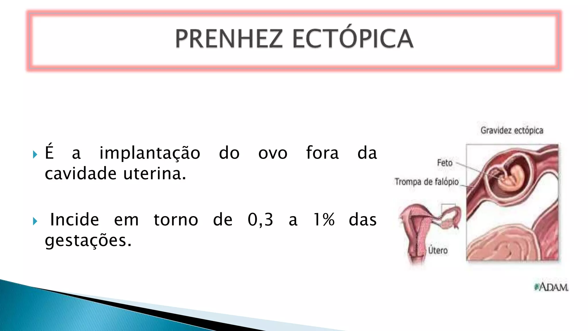  É a implantação do ovo fora da
cavidade uterina.
 Incide em torno de 0,3 a 1% das
gestações.
 