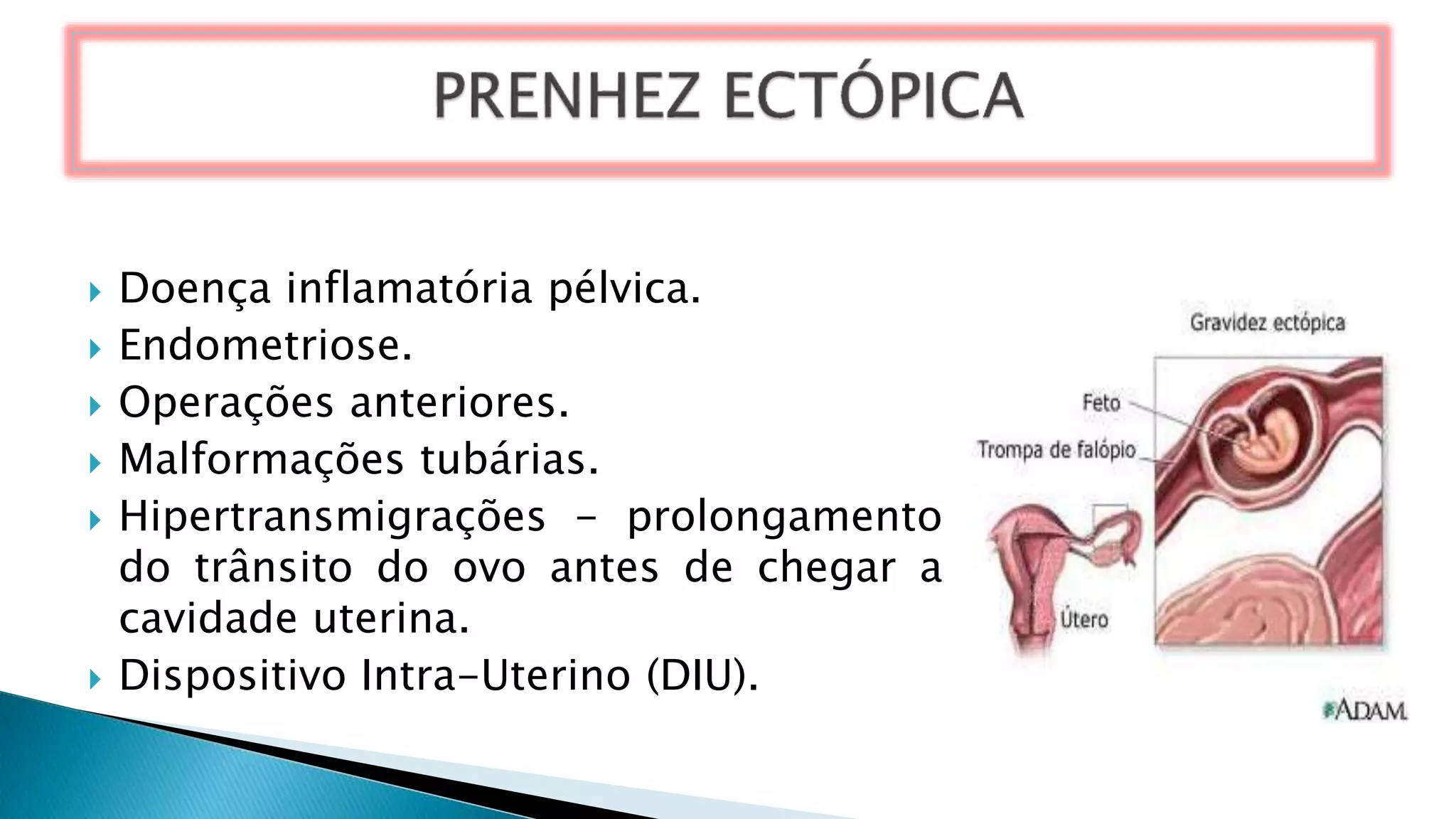  Doença inflamatória pélvica.
 Endometriose.
 Operações anteriores.
 Malformações tubárias.
 Hipertransmigrações - prolongamento
do trânsito do ovo antes de chegar a
cavidade uterina.
 Dispositivo Intra-Uterino (DIU).
 