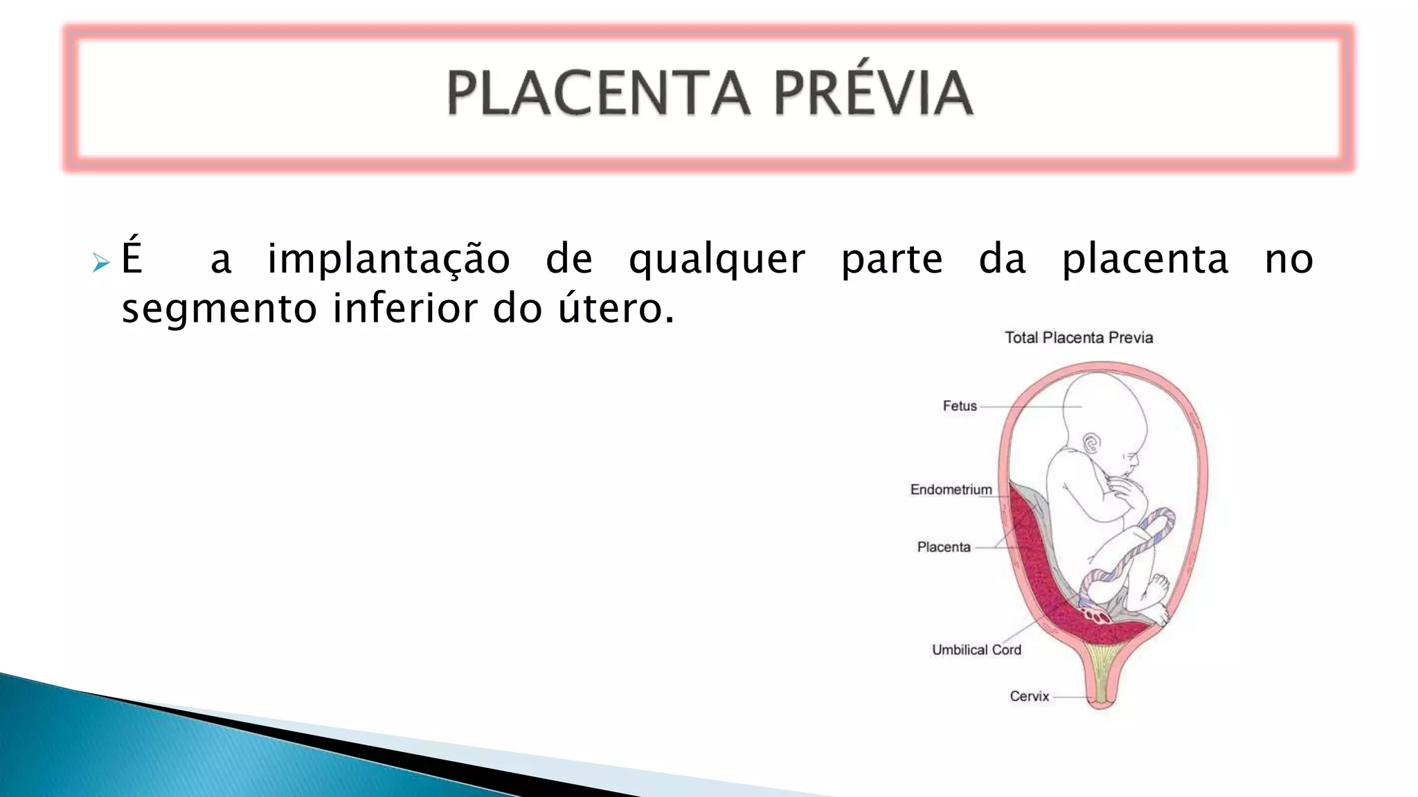  É a implantação de qualquer parte da placenta no
segmento inferior do útero.
 