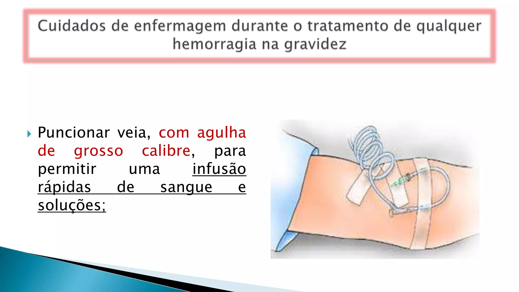  Puncionar veia, com agulha
de grosso calibre, para
permitir uma infusão
rápidas de sangue e
soluções;
 