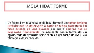  De forma bem resumida, mola hidatiforme é um tumor benigno
irregular que se desenvolve a partir de tecido placentário em
fases precoce de uma gravidez em que o embrião não se
desenvolve normalmente, se apresenta sob a forma de um
aglomerado de vesículas semelhantes à um cacho de uvas. Sua
etiologia é desconhecida.
 