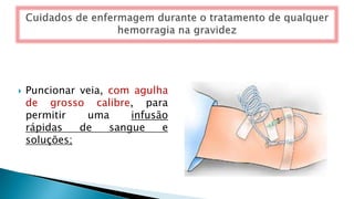  Puncionar veia, com agulha
de grosso calibre, para
permitir uma infusão
rápidas de sangue e
soluções;
 