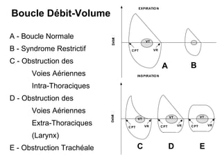 CPT VR
INSPIRATIO N
EXPIRATIO N
VT
CPT VR
VT
C D
CPT VR
VT
E
A
CPT VR
VT
B
Boucle Débit-Volume
A - Boucle Normale
B - Syndrome Restrictif
C - Obstruction des
Voies Aériennes
Intra-Thoraciques
D - Obstruction des
Voies Aériennes
Extra-Thoraciques
(Larynx)
E - Obstruction Trachéale
 