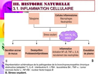 III. HISTOIRE NATURELLE
        3.1. INFLAMMATION CELLULAIRE




                                                          O2 - OH- H2 O2
                                                               HOCl




Représentation schématique de la pathogenèse de la bronchopneumopathie chronique
obstructive (adaptée [47]). IL-8 : interleukine 8 ; LTB4 : leucotriène B4 ; TNF-⍺ : tumor
necrosis factor ⍺ ; NF-KB : nuclear factor-kappa B
B. Stress oxydant.
 