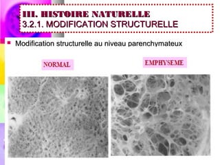 III. HISTOIRE NATURELLE
      3.2.1. MODIFICATION STRUCTURELLE

   Modification structurelle au niveau parenchymateux
 