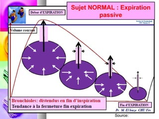 Sujet NORMAL : Expiration
         passive




             Source:
 