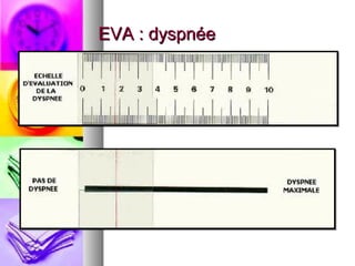 EVA : dyspnée
 